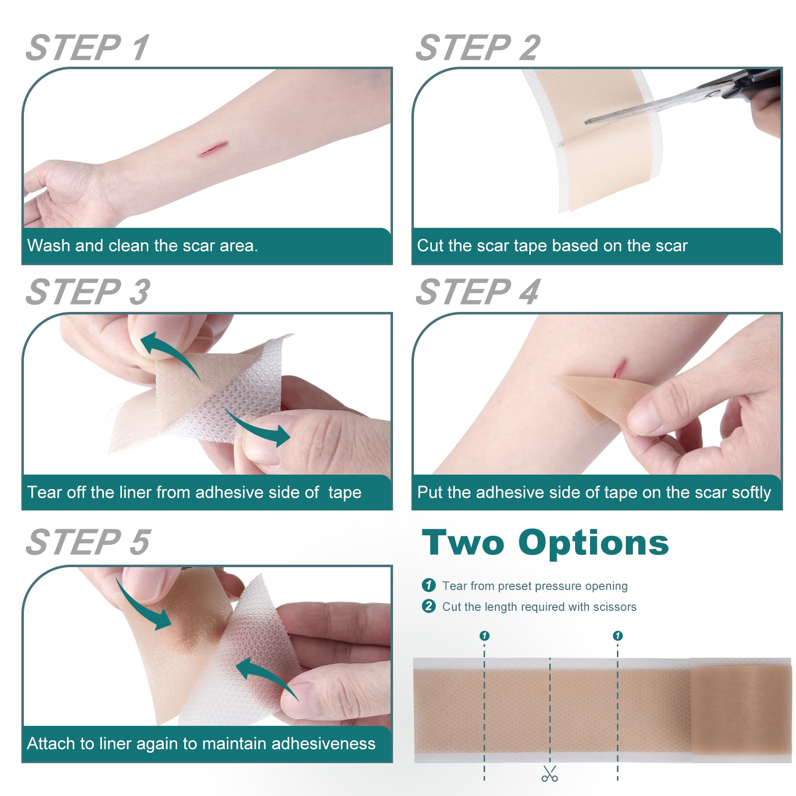 Silicone Scar Sheets (1.6''x 79'' Roll-2M), Silicone Scar Tape for Scar Removal Treatment, Reusable Silicone Scar Strips for C-S