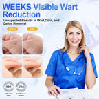 HEALMUSZ Wart Remover Liquid 5% Salicylic Acid Wart Freeze Off Wart Removal,Wart Remover Freeze Off for Genital,H Wa rt,Common,F