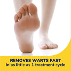 Dr. Scholl's Freeze Away WART Remover, 12 Applications // Doctor-Proven Freeze Therapy to Remove Common and Plantar Warts Fast,