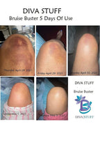 Bruise Buster Cream By Diva Stuff 4oz, 2 pack