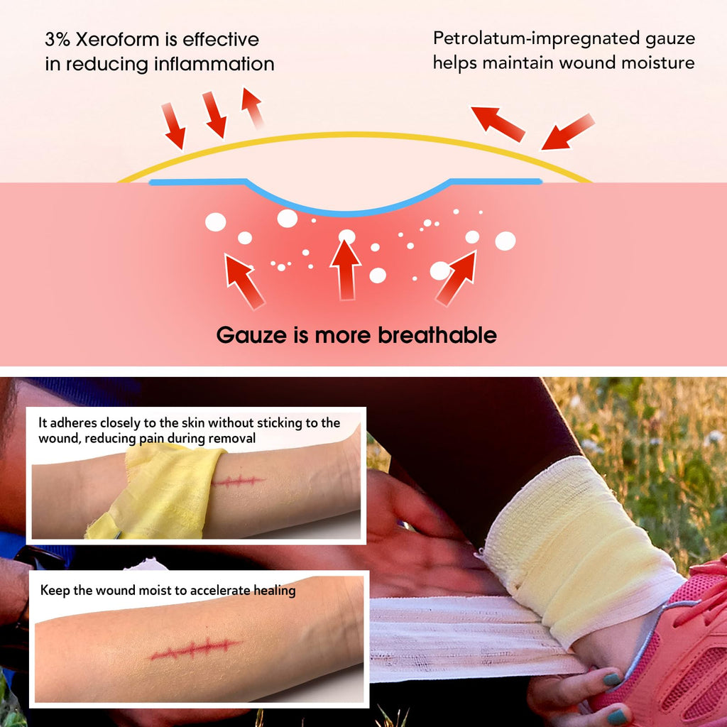 POLYNEW Xeroform Petrolatum Dressing 5x9, 25 PCS Non-Adherent Gauze for Low Exudating Wounds, Fine Mesh Gauze Pads for Burns, Ab