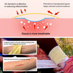 POLYNEW Xeroform Petrolatum Dressing 5x9, 25 PCS Non-Adherent Gauze for Low Exudating Wounds, Fine Mesh Gauze Pads for Burns, Ab