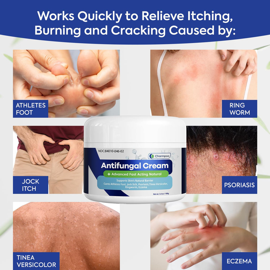 Charmpoo Antifungal Cream for Jock Itch: 2% Miconazole Anti Fungal Cream for Itchy Skin Relief Extra Strength - Ringworm Treatme