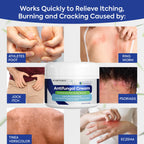 Charmpoo Antifungal Cream for Jock Itch: 2% Miconazole Anti Fungal Cream for Itchy Skin Relief Extra Strength - Ringworm Treatme