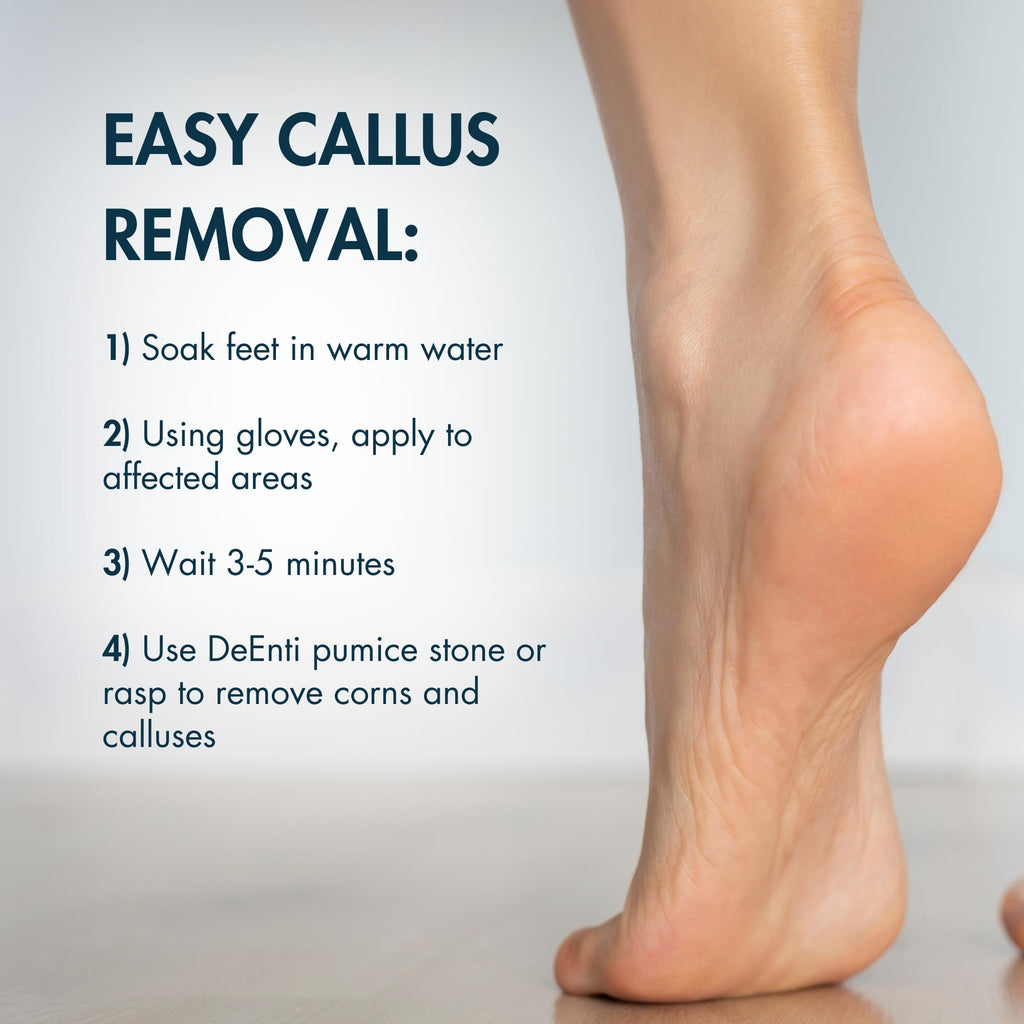 DeEnti Callus Maintenance Pack, Bundle Includes Mint Scented Callus Remover, Metal Foot Rasp, Foot File, and 4 Pairs of Gloves,