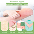 Umex Intensive Itch Relief Cream - Daily Moisturizing Lotion for Sensitive Skin, Soothes Dry & Flaky Skin, Non-Greasy & Fragranc