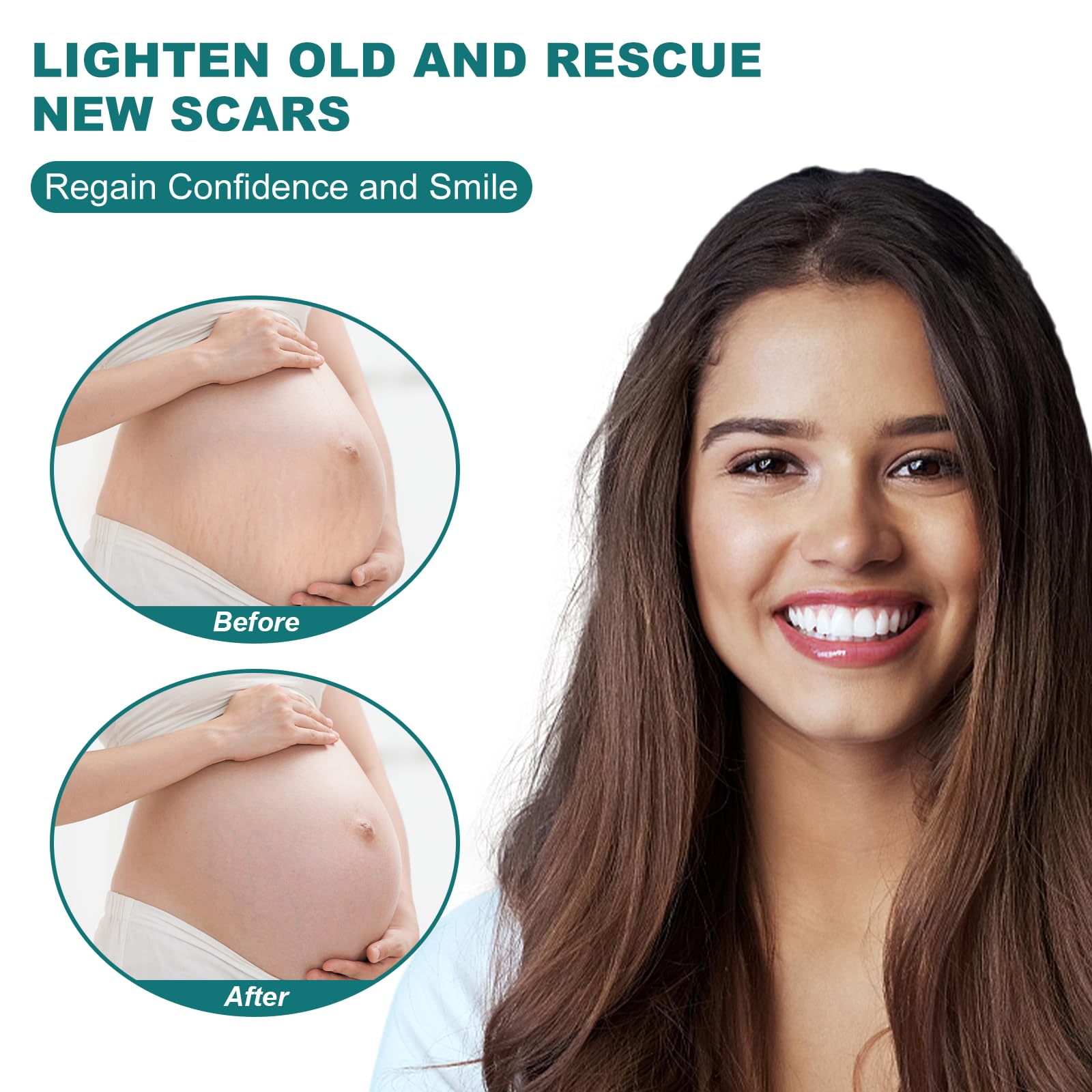 Silicone Scar Sheets (1.6''x 79'' Roll-2M), Silicone Scar Tape for Scar Removal Treatment, Reusable Silicone Scar Strips for C-S