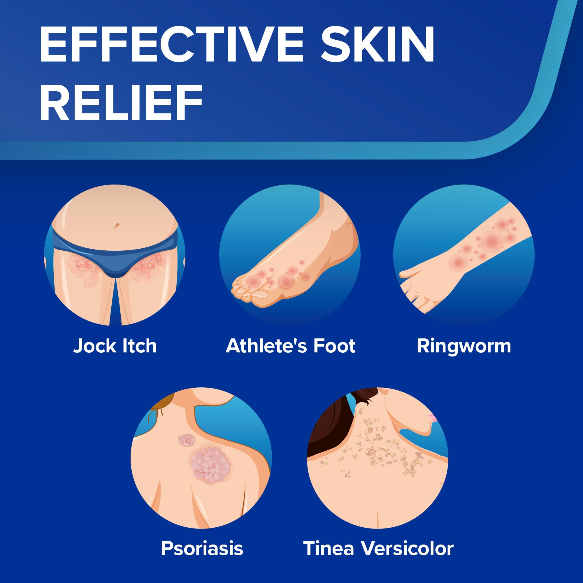 FungiFree Jock Itch Antifungal Cream: Psoriasis and Ringworm Treatment for Skin, Foot & Body - Soothing Itchy Relief for Men and