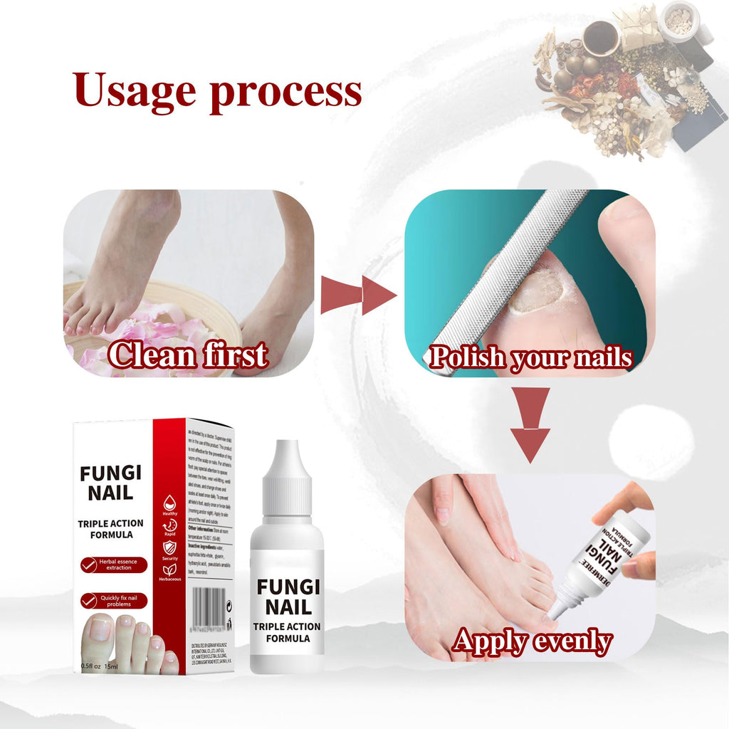 Toenail Fungus Treatment, Herbal Extracts, Nighttime Long-Lasting Nail Treatment, Suitable for Discoloration, Shaped Nails, Thic