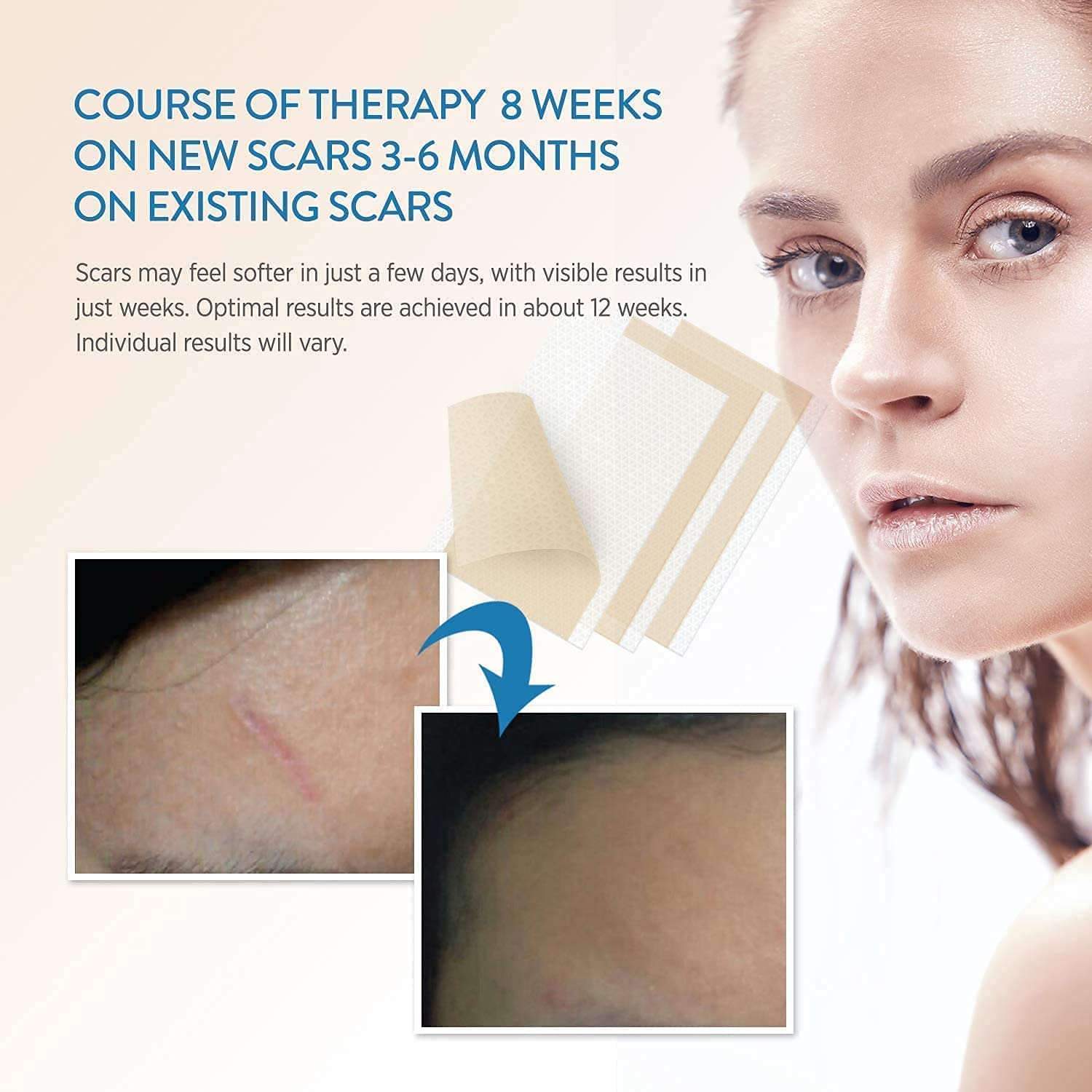 Aroamas Scar Professional Soft Silicone Scar Sheets Strips, Soften and Flattens Scars Resulting from Surgery, Injury, Burns, C-S