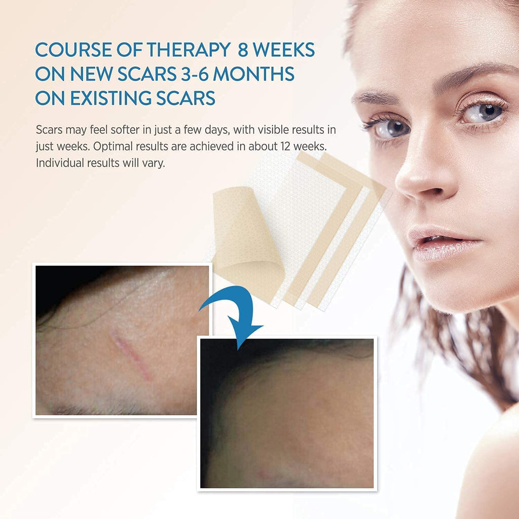 Aroamas Scar Professional Soft Silicone Scar Sheets Strips, Soften and Flattens Scars Resulting from Surgery, Injury, Burns, C-S