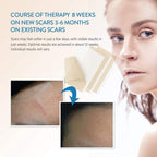 Aroamas Scar Professional Soft Silicone Scar Sheets Strips, Soften and Flattens Scars Resulting from Surgery, Injury, Burns, C-S