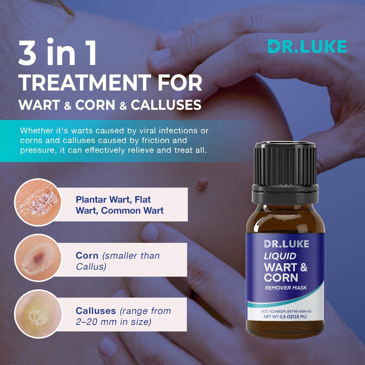 Plantar Wart Corn Remover Freeze Off For Feet: Strongest Wart Corn Removers for Toes Feet - Exclusive Formula 17% Salicylic Acid