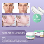 Skiennix Acne Scar Treatment for Face, Advanced Scar Gel, Treats Old and New Scars, Reduces the Appearance of Scars for Face Acn