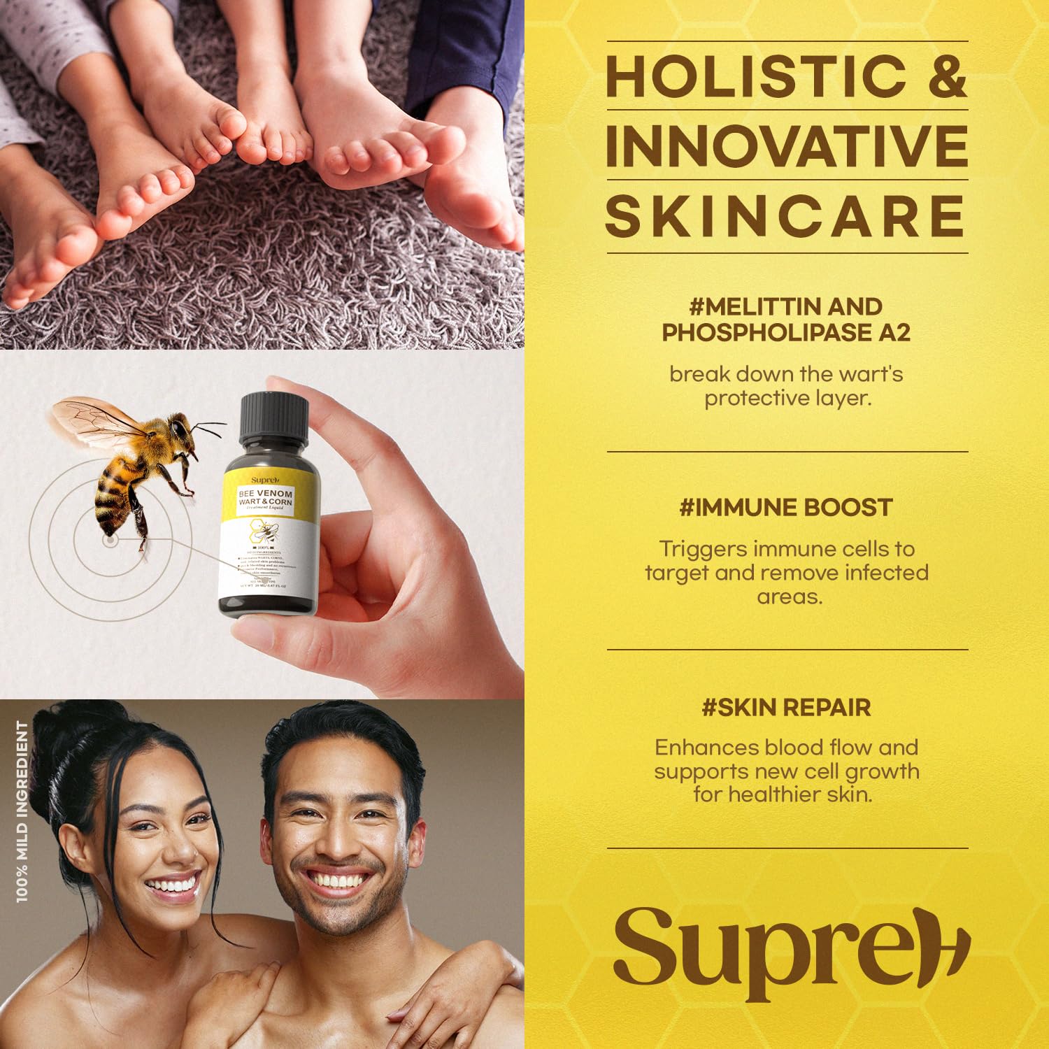 SupreH Fast-Acting bee Venom wart Remover: wart Freeze Off with salicylic Acid & bee Venom Cream - Wart Removal for Plantar Wart