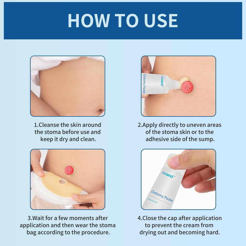 Ostomy Paste - Alcohol-Free Skin Barrier Ostomy Paste,Stoma Care Supplies Osotmy Supplies Accessories,Ostomy Bag Protect Skin Ba