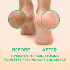 Lee Beauty Professional Callus Remover for Feet - Peppermint, Powerful Formulation - Extra Strength Gel, Home Pedicure Foot Spa