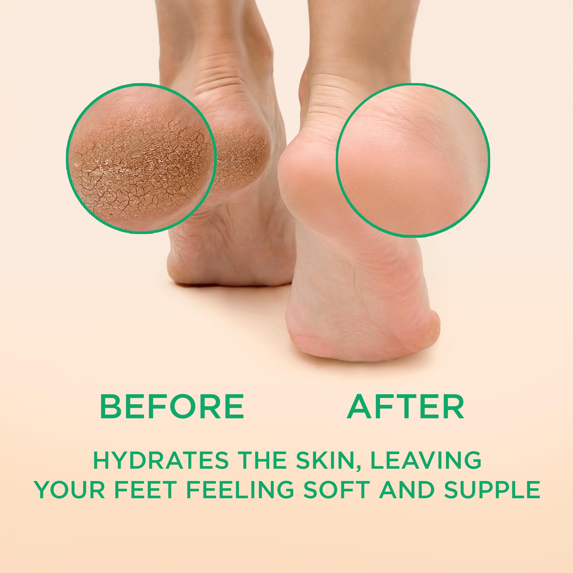 Lee Beauty Professional Callus Remover for Feet - Peppermint, Powerful Formulation - Extra Strength Gel, Home Pedicure Foot Spa
