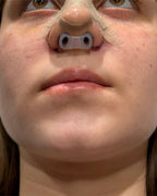 Nostril Retainer | Nostril Retainer for Rhinoplasty Recovery | Nose Retainer for Surgery | Nose Shaper & Support Device | 100% H