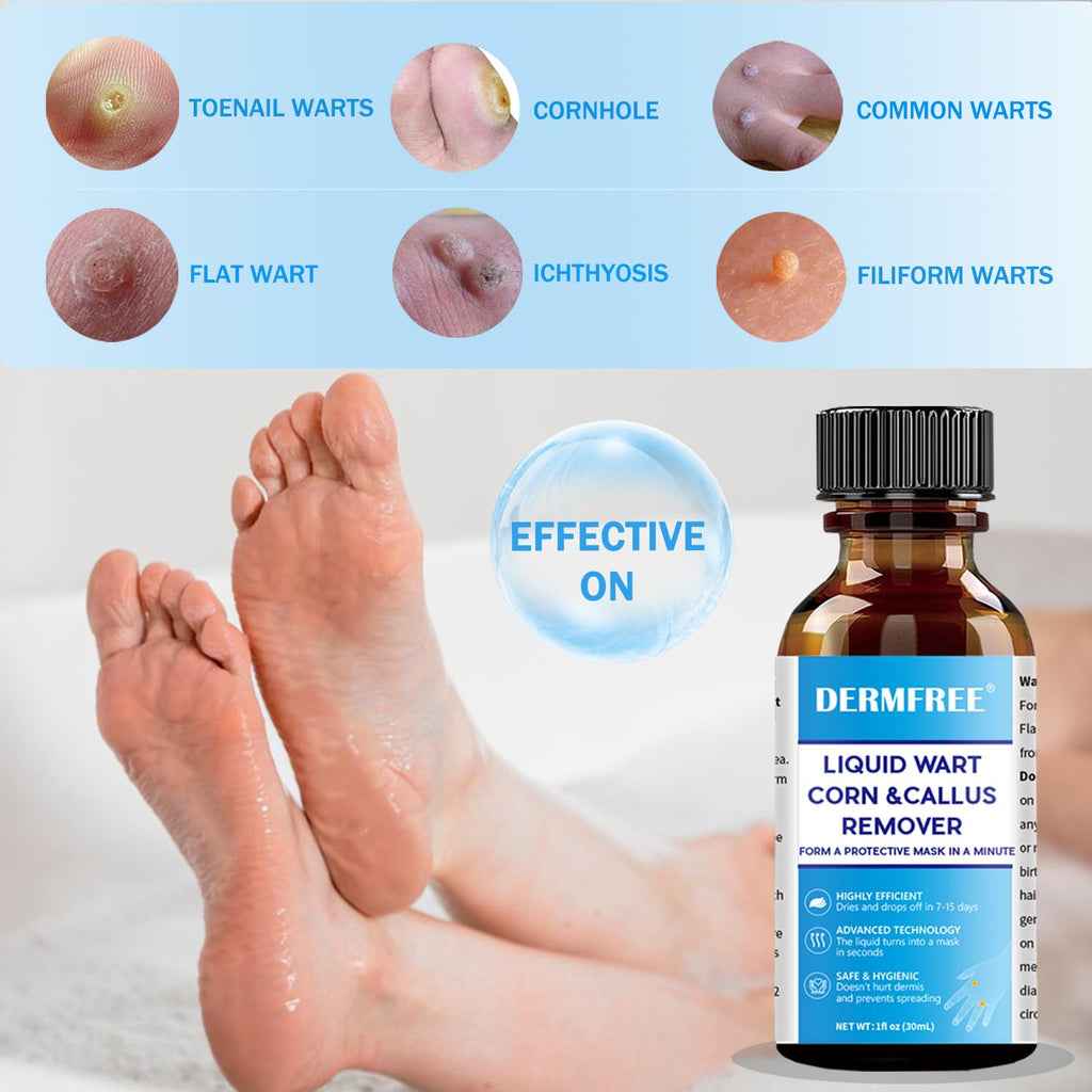 DERMFREE LIGUID WART Remover,Fast Action Wart Remover,17% salicylic Acid wart Remover, Plantar Wart, Common Wart, Flat Wart,Corn
