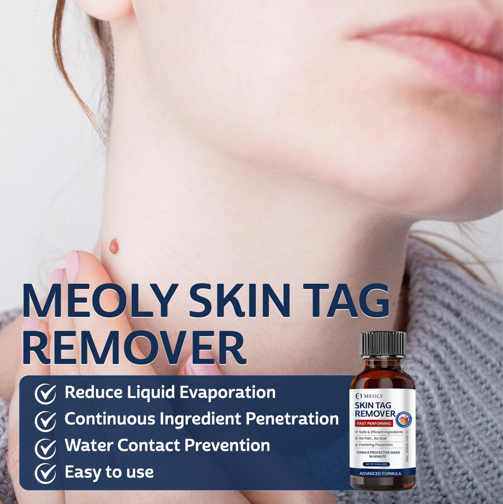 MEOLY Skin Tag Remover: Skin Tag Remover with Salicylic Acid for Men and Women 30 ML
