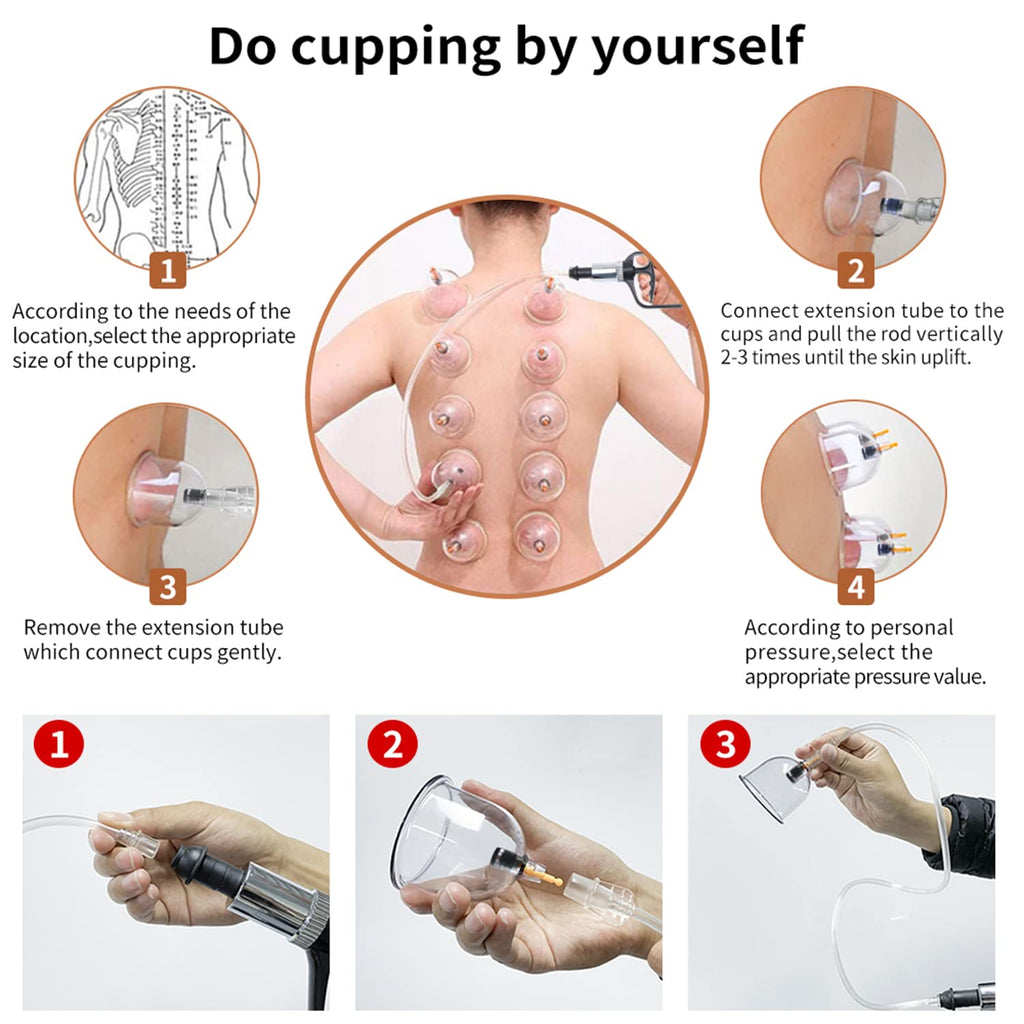 Cupping Therapy Set,32 Therapy Cups Cupping Set with Pump, Professional Chinese Acupoint Cupping Therapy Sets Hijama for Cupping