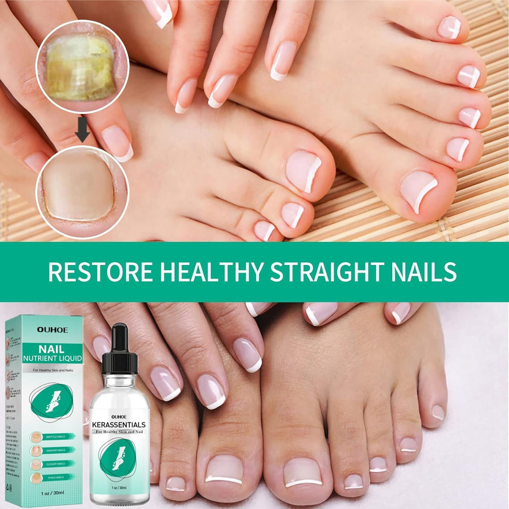 Kerassentials Nails Nutrient Oil,Kerassentials Toenail Oil,Nail Repair Solution,Nail Renewal Liquid For Damaged & Discoloration
