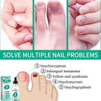 Kerassentials Nails Nutrient Oil,Kerassentials Toenail Oil,Nail Repair Solution,Nail Renewal Liquid For Damaged & Discoloration