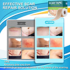Medical Grade Silicone Scar Tape for Surgical Scars (1.6'' x 120'' - 3M) Professional Silicone Scar Sheets Scar Treatment for Fa