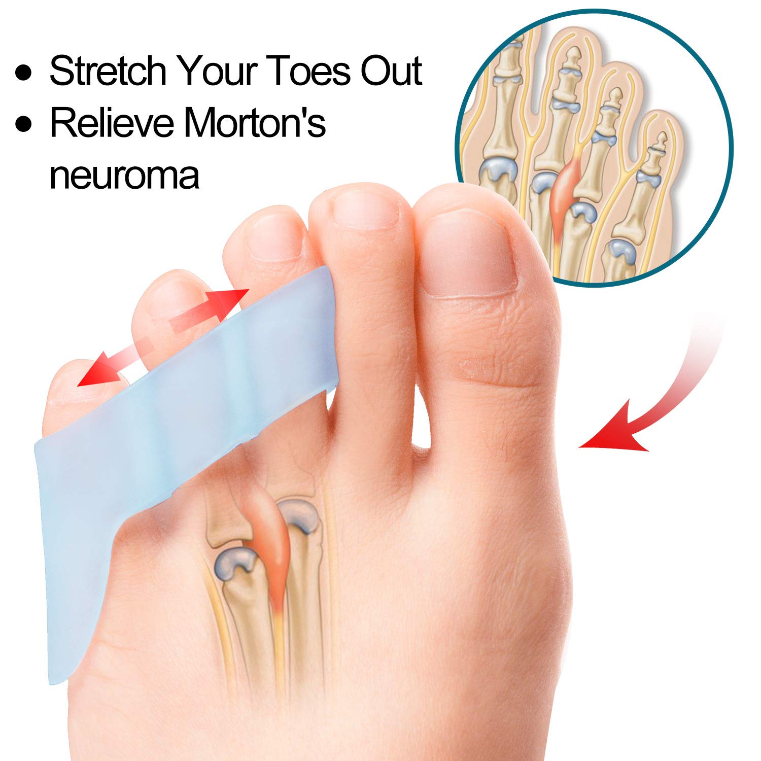 Povihome 10 Pack Pinky Toe Separator and Protectors for Overlapping Toe, Curled Pinky Toes - Spacers for Morton's Neuroma Pain R