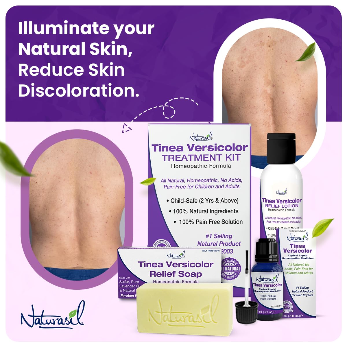 Naturasil Antifungal Tinea Versicolor Treatment Kit Gentle & Fast Relief for All Types of Tinea, Folliculitis, Itch & Chilblains