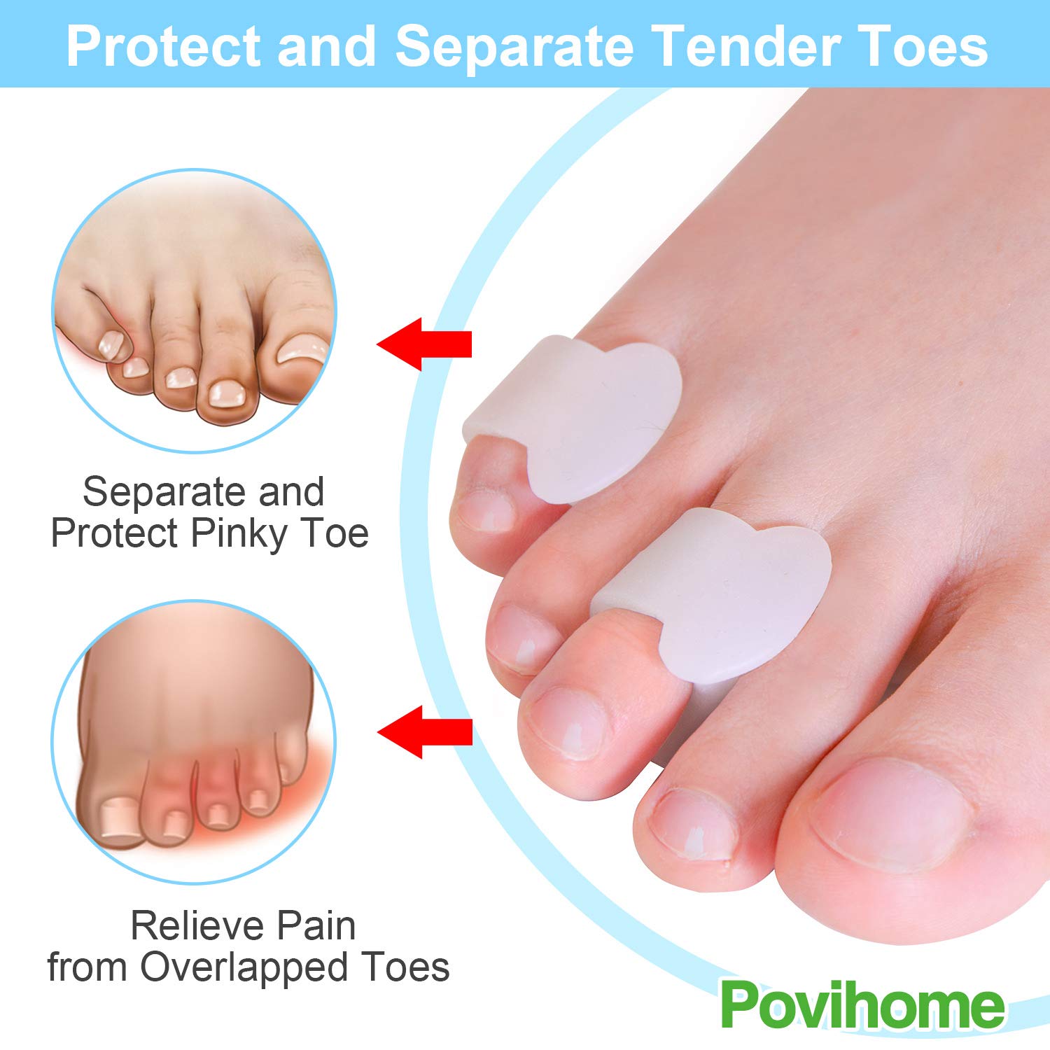 Povihome 10 Pack Pinky Toe Separators, Little Toe Spacers to Separate and Protect Pinky Toe or Smaller Toes, Relieve Pain from F