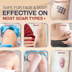 Ebanel Advanced Silicone Scar Gel with Onion Extract, Allantoin, Emu Oil, Vitamin E, Medical-Grade Scar Cream for Old & New Scar