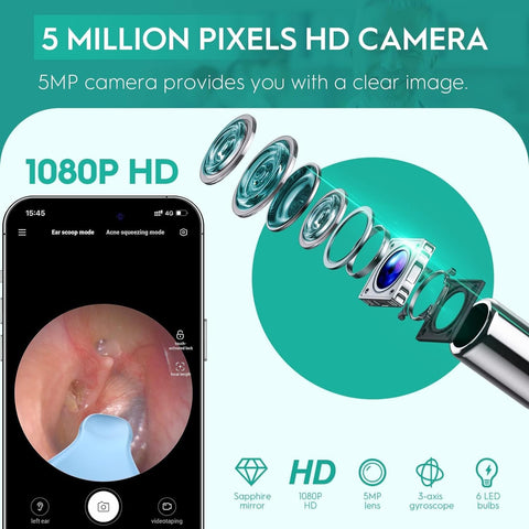 Earwax Camera Ear Camera Otoscope Cleaner, Oxbird 1080P Wireless Ear Wax Removal Kit Smart Ear Cleaner with Camera and Light for
