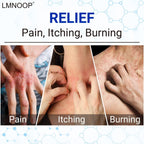 LMNOOP Eczema Cream, Maximum Strength Treatment Ointment for Rash, Psoriasis, Dermatitis, Urticaria, Jock Itch, Fungal Infection