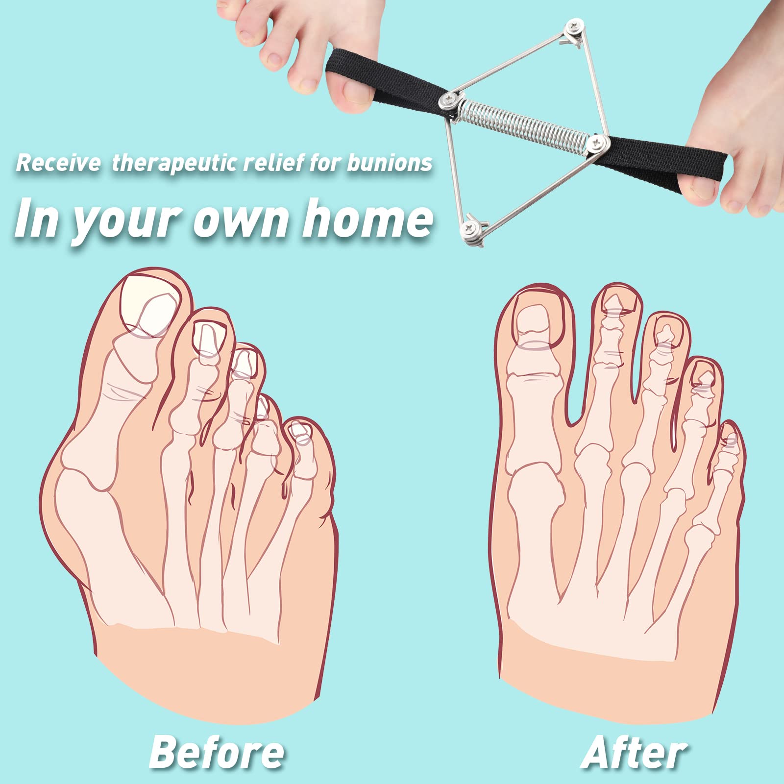 Pilates Toe Stretcher Bunion, Hallux Valgus Big Toe Strap Spacer Tension Bunion Exercise Band Stretchy Alignment Splint Restores