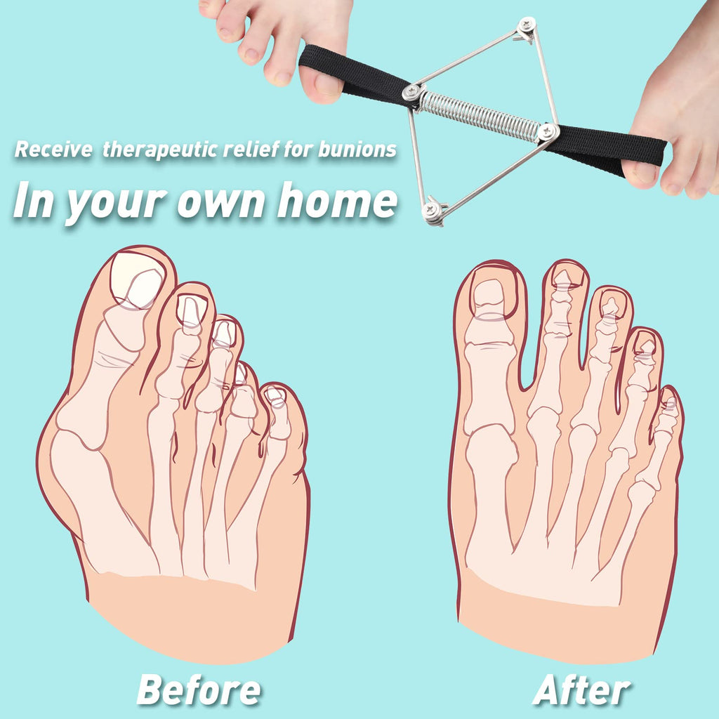 Pilates Toe Stretcher Bunion, Hallux Valgus Big Toe Strap Spacer Tension Bunion Exercise Band Stretchy Alignment Splint Restores