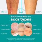 Medi Grade Silicone Scar Sheets, 80 Inches Long - Reusable Tape for C-Section, Keloid, Burn, Acne and Surgical Scars - Silicone