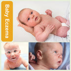 Baby Eczema Cream - Kids Eczema Therapy & Relief Body Cream, Nourishing Skin Protectant Soothes & Relieves Dry, Hypoallergenic,