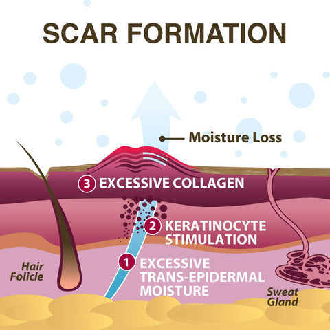 Xeragel 100% Silicone Scar Treatment Ointment - Clinically Proven to Reduce the Appearance of Old & New Scars - Sealed Tube, 10g