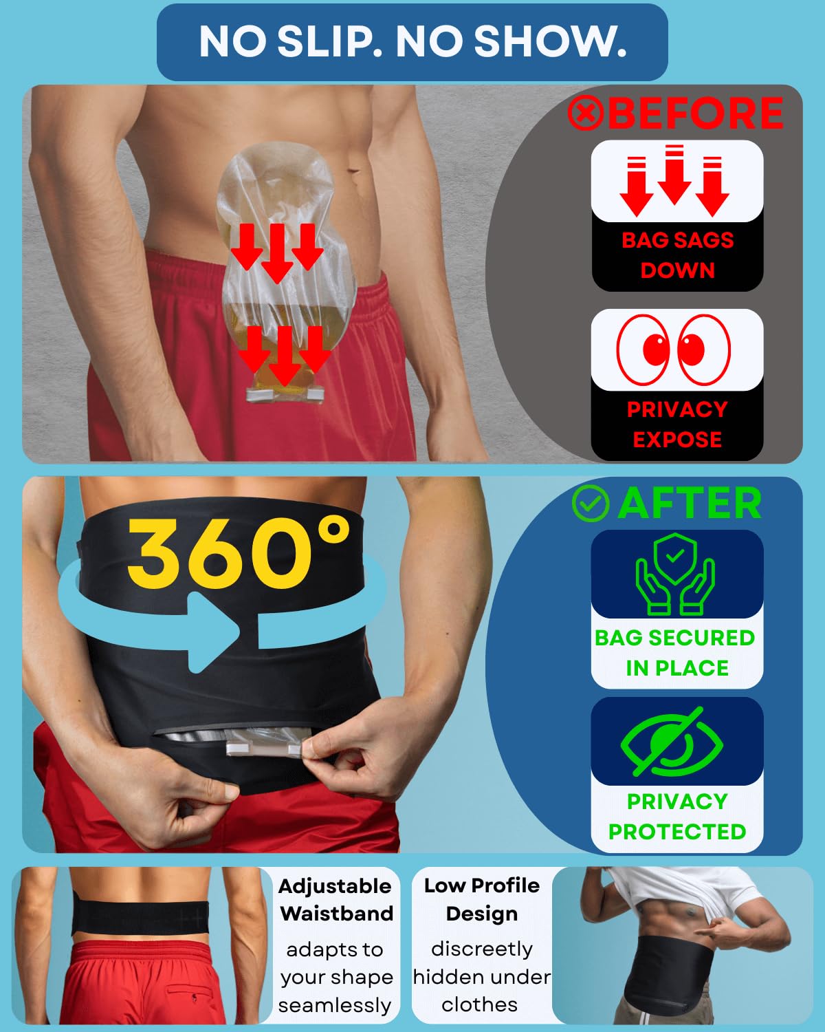 Caredgitz Ostomy Belt, Ostomy Bag Covers for Women, Discreet Colostomy Bags Cover for Men, Ileostomy Bag Covers Leak Proof, Adju