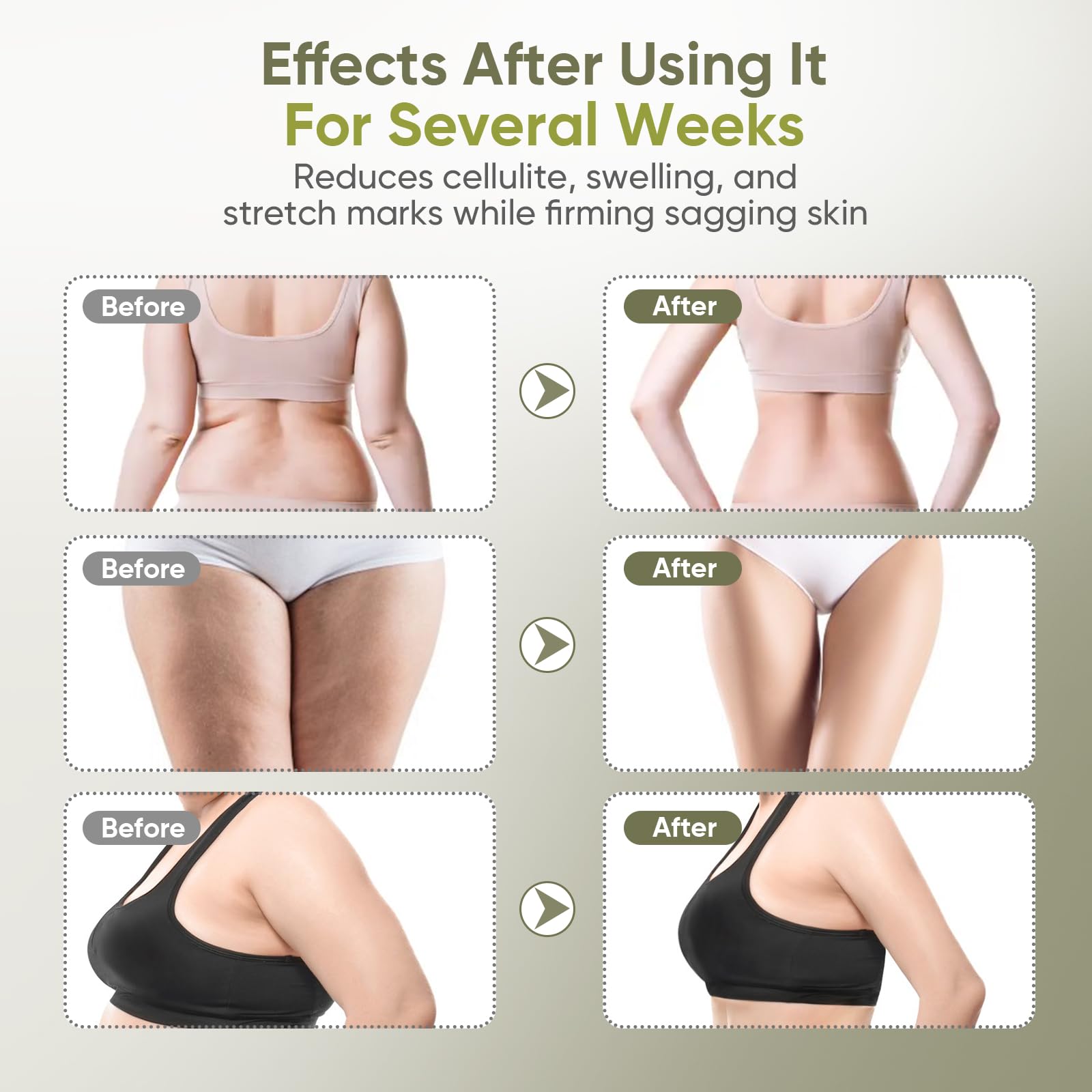 Lymphatic Drainage Massager & Anti-Cellulite Tool - Body Sculpting Machine with Microcurrent, Light, Heat & Vibration for Legs,