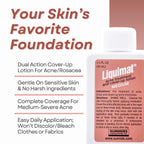 Liquimat Medium Acne Treatment Lotion & Blemish Concealer - Skin Clearing Oil-Free Liquid Foundation For Acne Prone Skin With 4%