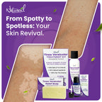 Tinea Versicolor Full Body Value Pack - Targeted Relief Liquid (15mL) + 1 Anti-Itch Soap | Natural Ingredients for Ringworm, Can