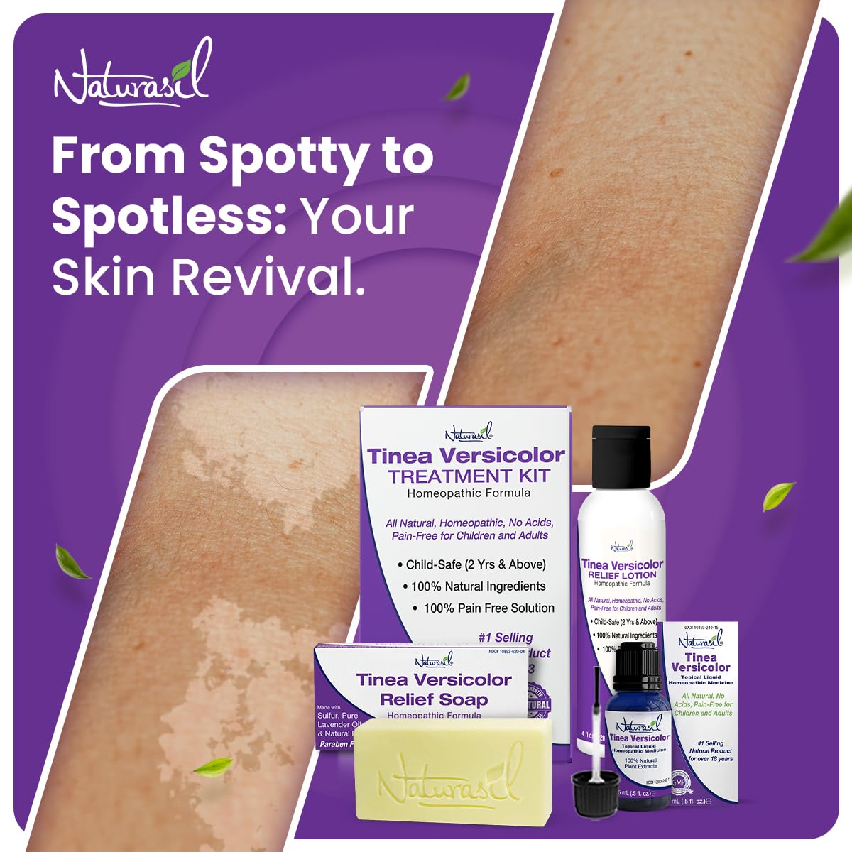 Tinea Versicolor Full Body Value Pack - Targeted Relief Liquid (15mL) + 1 Anti-Itch Soap | Natural Ingredients for Ringworm, Can