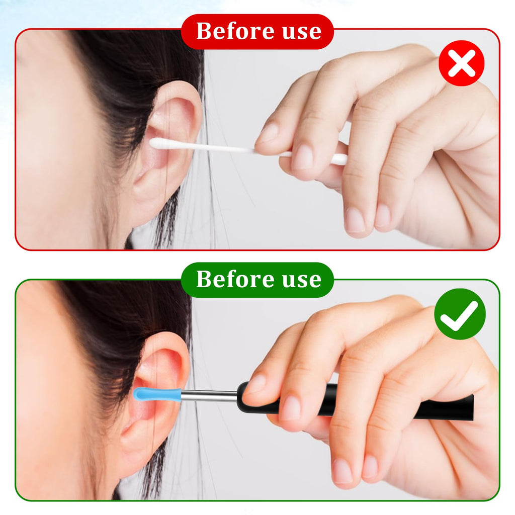Ear Wax Removal Replacement Tips for Ear Camera 30Pcs Ear Spoon Tips for Wet/Dry Ear Ear Cleaner Tips Wax Cleaning Ear Spoons Ti