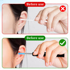 Ear Wax Removal Replacement Tips for Ear Camera 30Pcs Ear Spoon Tips for Wet/Dry Ear Ear Cleaner Tips Wax Cleaning Ear Spoons Ti