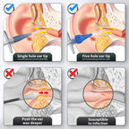Ear Wax Removal, Ear Cleaner, Ear Wax Removal Kit, Ear Wax Removal Tool, Manual Ear Irrigation Flushing System, Ear Cleaning Kit