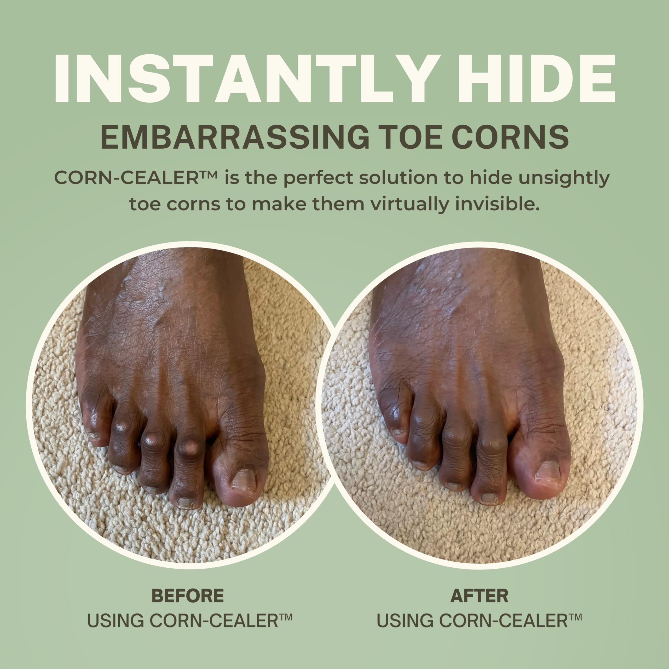 CORN-CEALER | Toe Corn Makeup | Instantly Hide Toe Corns | Concealer For Toe Corns (Shade-CHESTNUT)
