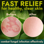 Antifungal Cream | Body Cream for Jock Itch, Ringworm & Athletes Foot | Strength Formula with Tea Tree Oil | Helps With Itching,
